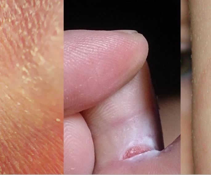 Clotrimazole powder Functions